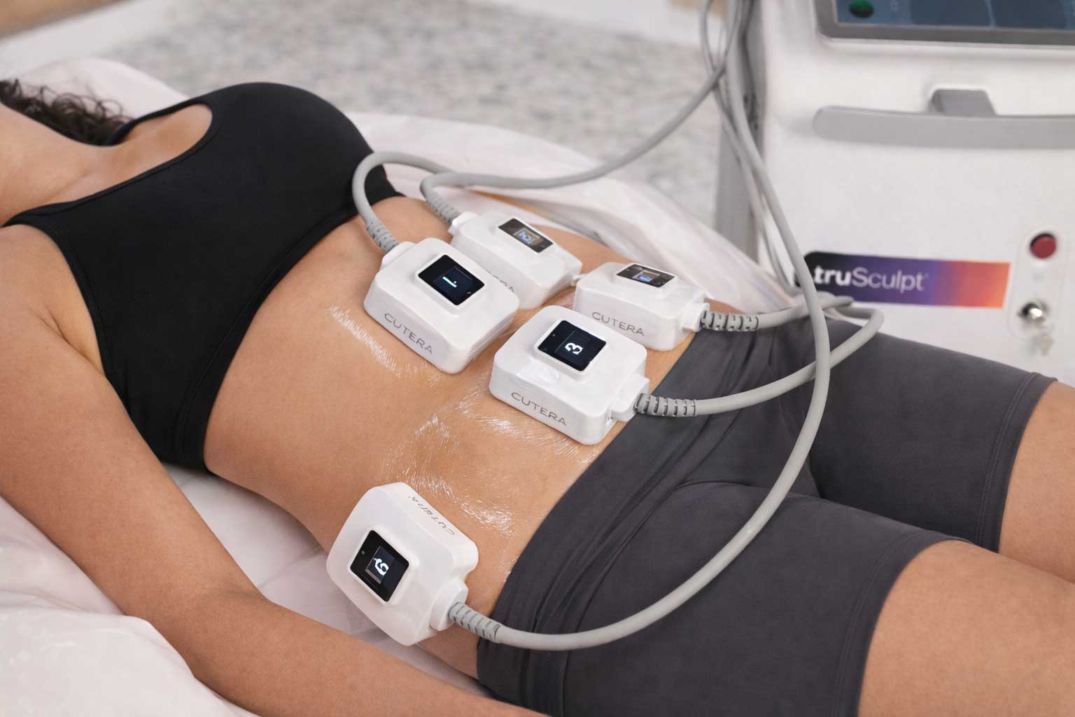 Can You Combine truSculpt Flex with truSculpt iD for Fat Loss and Muscle Toning? Solutions in Ft. Lauderdale.